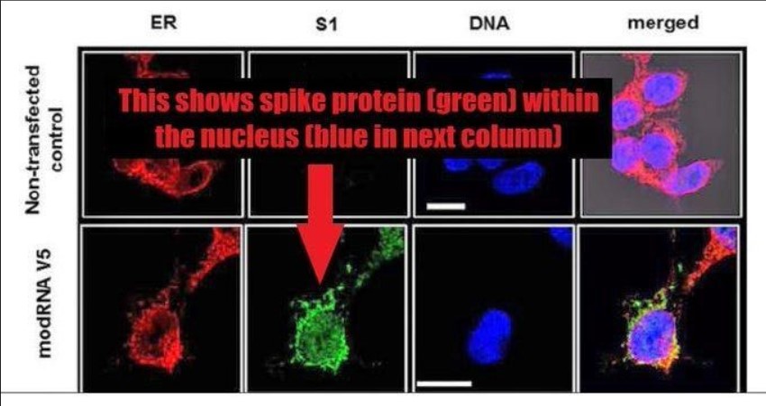 Sante rna